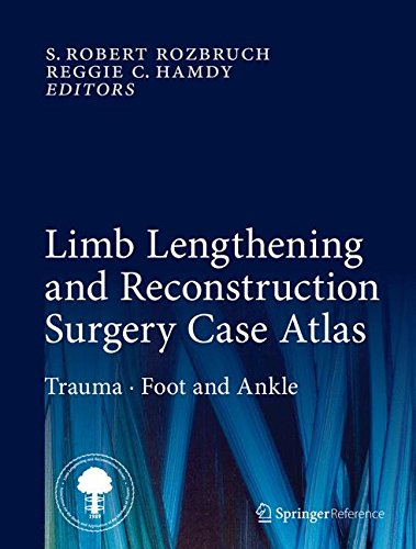 Limb Lengthening and Reconstruction Surgery Case Atlas: Trauma • Foot and Ankle