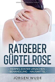 Ratgeber Gürtelrose: Herpes Zoster Ursachen Behandlung Hausmittel