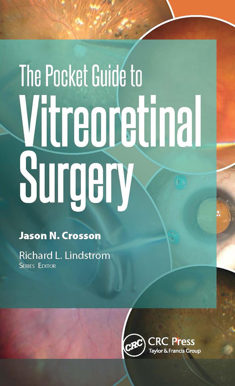 The Pocket Guide to Vitreoretinal Surgery (Pocket Guides)