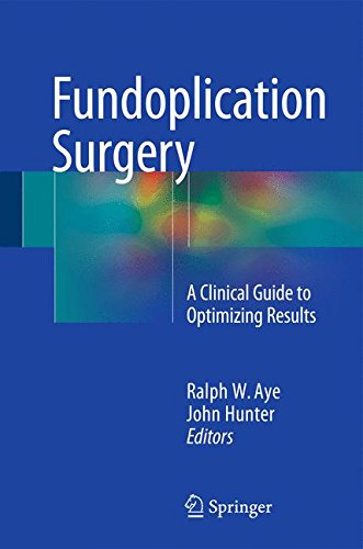 Fundoplication Surgery: A Clinical Guide to Optimizing Results