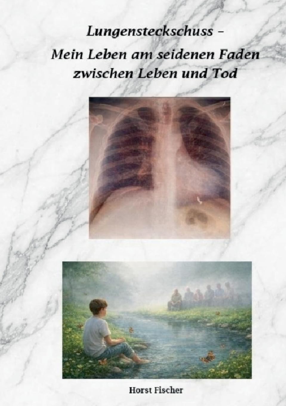 Lungensteckschuss - Mein Leben am seidenen Faden zwischen Leben und Tod