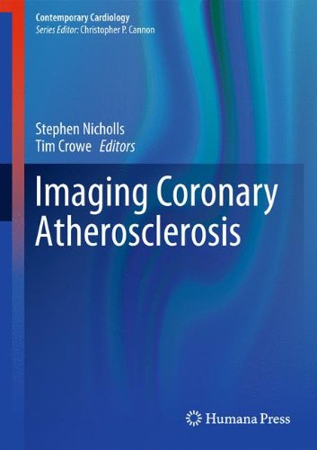 Imaging Coronary Atherosclerosis (Contemporary Cardiology)