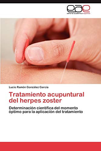 Tratamiento acupuntural del herpes zoster: Determinación científica del momento óptimo para la aplicación del tratamiento