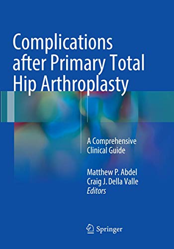 Complications after Primary Total Hip Arthroplasty: A Comprehensive Clinical Guide