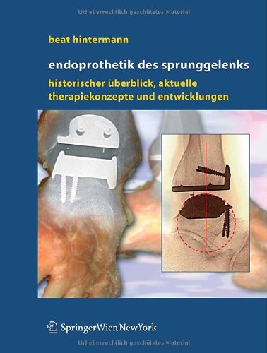 Endoprothetik des Sprunggelenks: Historischer Überblick, aktuelle Therapiekonzepte und Entwicklungen: Historischer Uberblick, Aktuelle Therapiekonzepte Und Entwicklungen