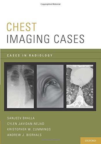 Chest Imaging Cases (Cases in Radiology)