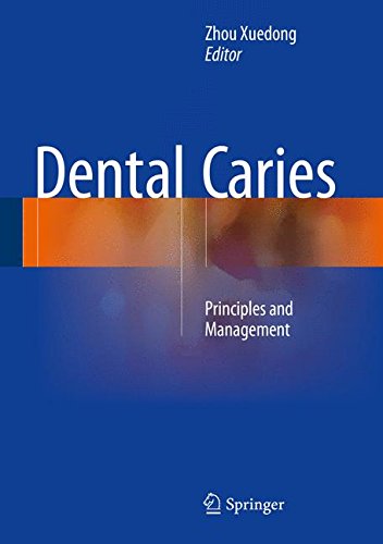Dental Caries: Principles and Management