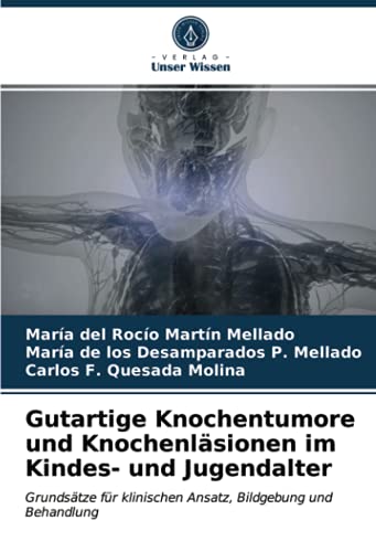 Gutartige Knochentumore und Knochenläsionen im Kindes- und Jugendalter: Grundsätze für klinischen Ansatz, Bildgebung und Behandlung