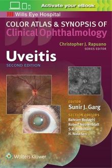 Uveitis (Color Atlas and Synopsis of Clinical Ophthalmology) (Color Atlas & Synopsis of Clinical Ophthalmology)