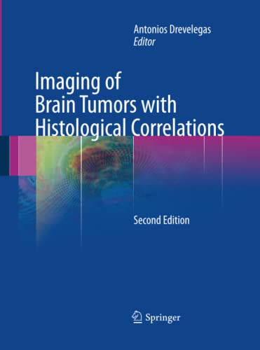 Imaging of Brain Tumors with Histological Correlations