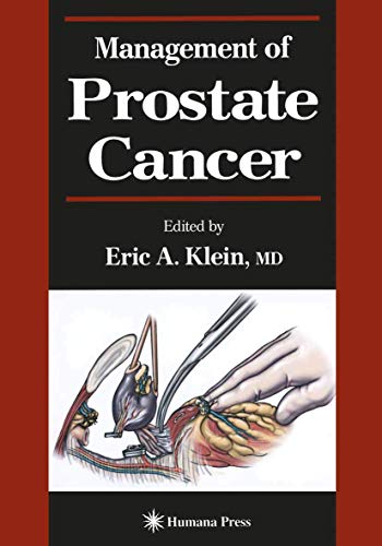 Management of Prostate Cancer (Current Clinical Urology)