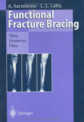 Functional Fracture Bracing: Tibia, Humerus, and Ulna