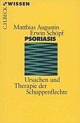 Psoriasis: Ursachen und Therapie der Schuppenflechte