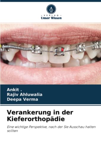 Verankerung in der Kieferorthopädie: Eine wichtige Perspektive, nach der Sie Ausschau halten sollten