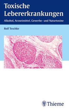 Toxische Lebererkrankungen. Alkohol, Arzneimittel, Gewerbe- und Naturtoxine