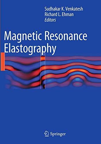 Magnetic Resonance Elastography