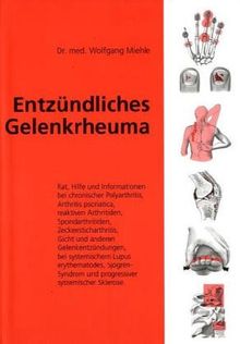 Entzündliches Gelenkrheuma. Rat, Hilfe und Informationen