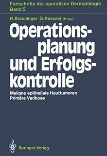 Operationsplanung und Erfolgskontrolle. Maligne epitheliale Hauttumoren. Primäre Varikose (Fortschritte der operativen und onkologischen Dermatologie) ... und onkologischen Dermatologie, 5, Band 5)