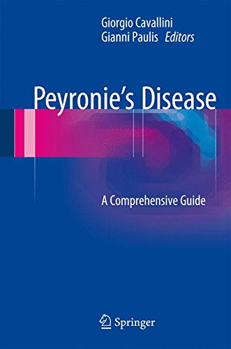 Peyronie's Disease: A Comprehensive Guide