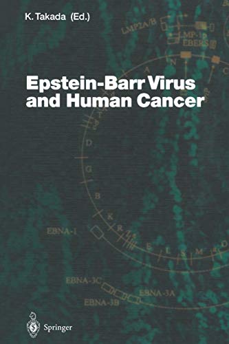 Epstein-Barr Virus and Human Cancer (Current Topics in Microbiology and Immunology, 258, Band 258)