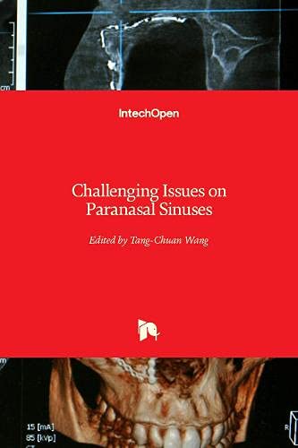 Challenging Issues on Paranasal Sinuses