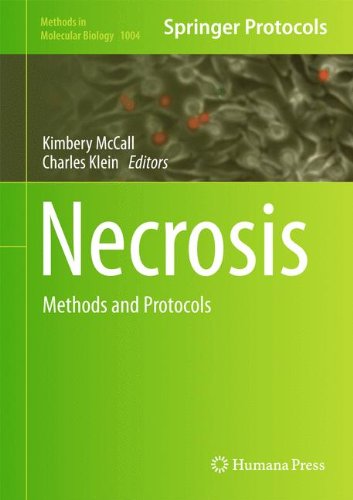Necrosis: Methods and Protocols (Methods in Molecular Biology)