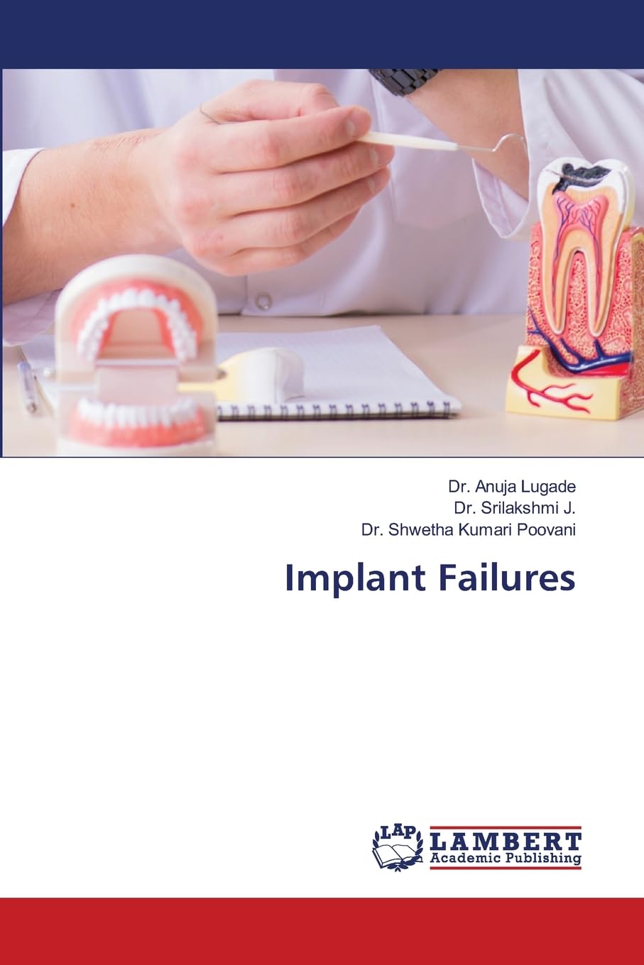 Implant Failures: DE
