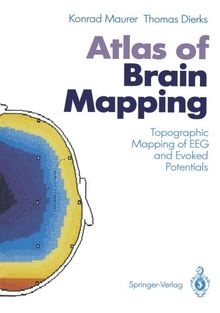 Atlas of Brain Mapping: Topographic Mapping of Eeg and Evoked Potentials