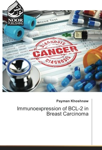 Immunoexpression of BCL-2 in Breast Carcinoma