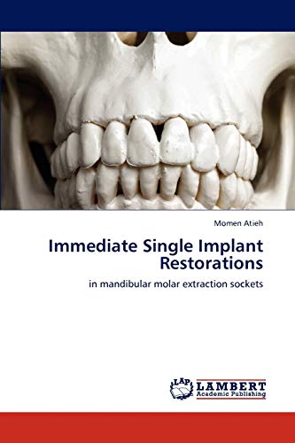Immediate Single Implant Restorations: in mandibular molar extraction sockets
