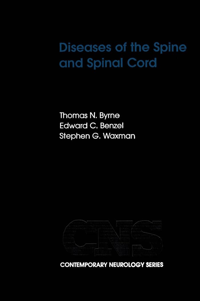 Diseases of the Spine and Spinal Cord (Contemporary Neurology Series, Band 58)