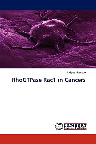RhoGTPase Rac1 in Cancers