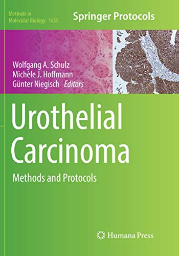 Urothelial Carcinoma: Methods and Protocols (Methods in Molecular Biology, Band 1655)
