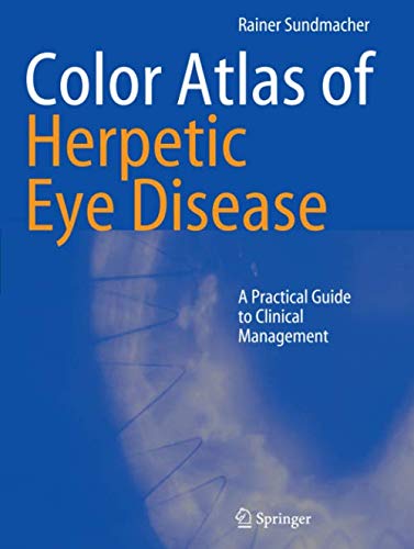 Color Atlas of Herpetic Eye Disease: A Practical Guide to Clinical Management