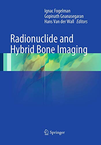 Radionuclide and Hybrid Bone Imaging