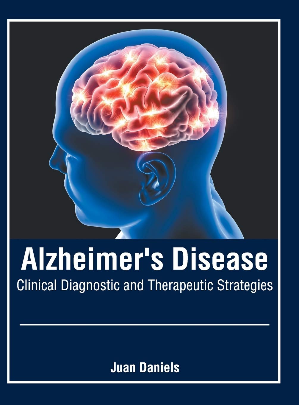 Alzheimer's Disease: Clinical Diagnostic and Therapeutic Strategies