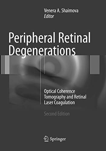 Peripheral Retinal Degenerations: Optical Coherence Tomography and Retinal Laser Coagulation