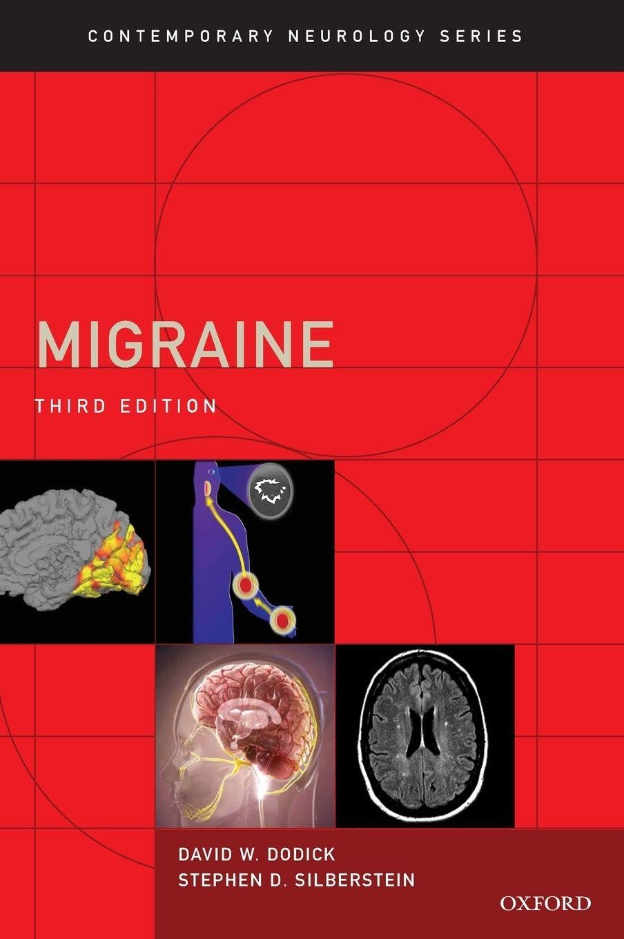 Migraine (Contemporary Neurology, 91, Band 91)