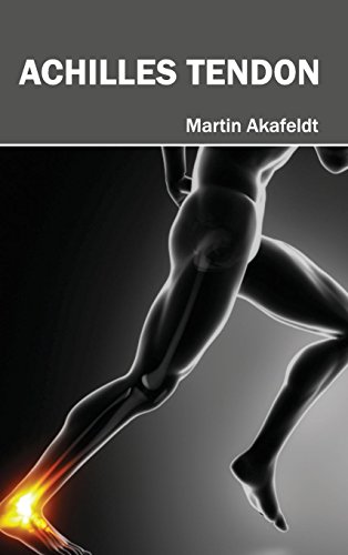 Achilles Tendon