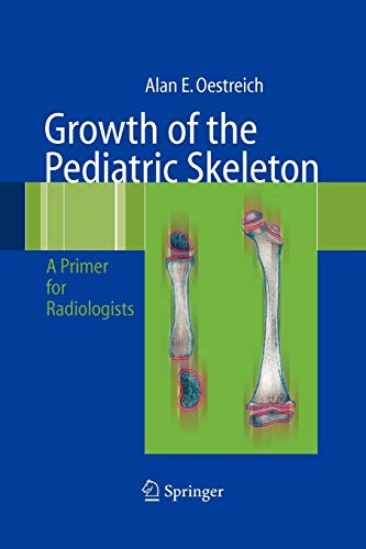 Growth of the Pediatric Skeleton: A Primer for Radiologists