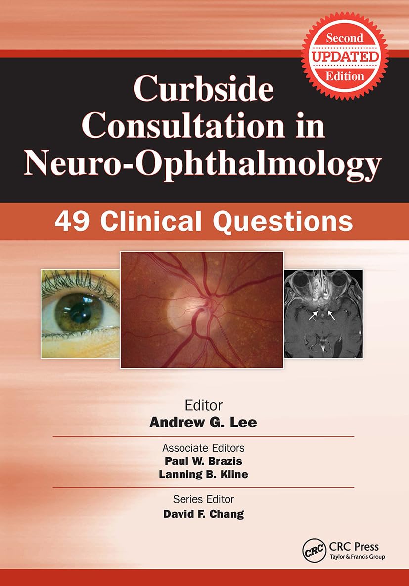 Curbside Consultation in Neuro-Ophthalmology: 49 Clinical Questions (Curbside Consultation in Ophthalmology)