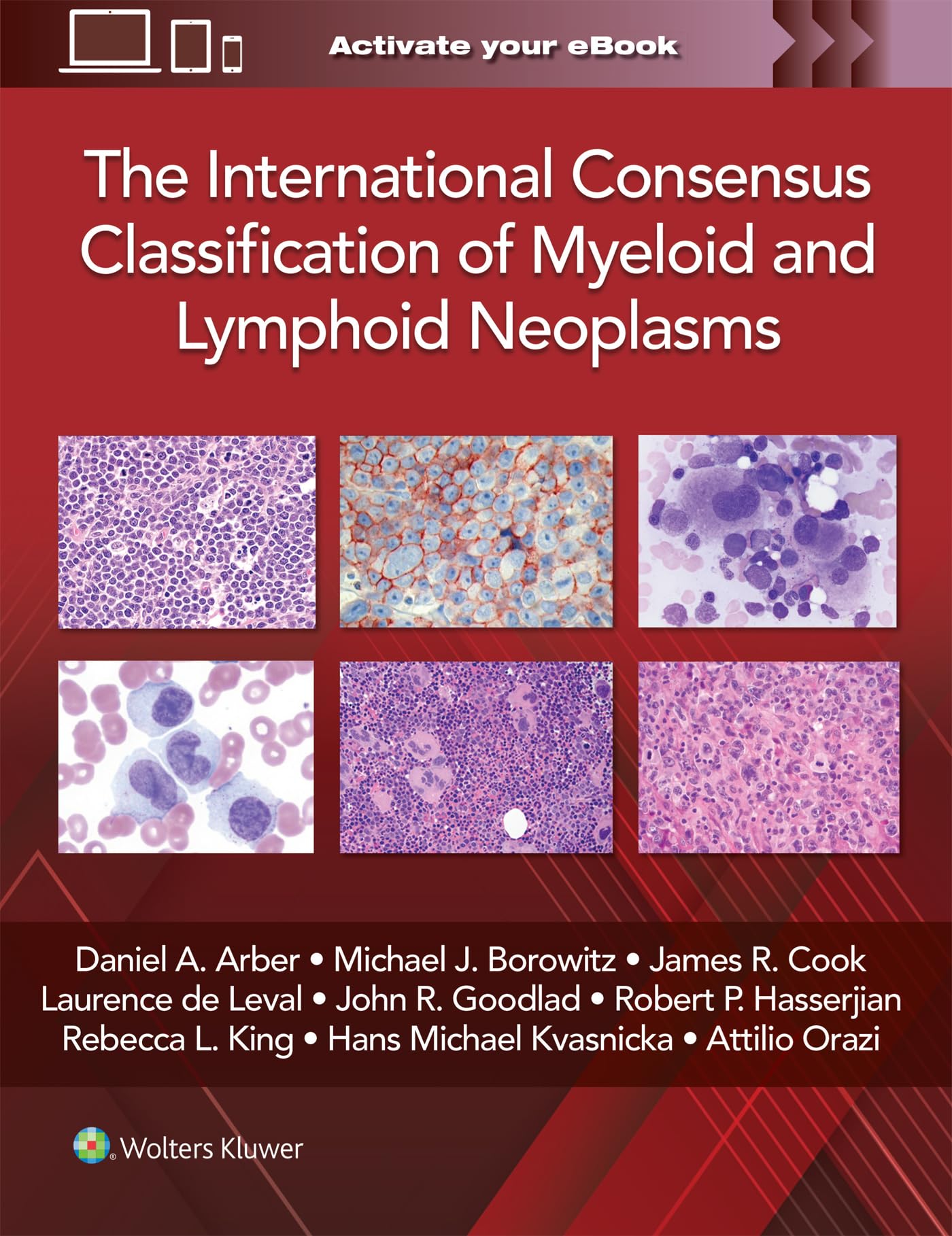 The International Consensus Classification of Myeloid and Lymphoid Neoplasms - Neuware
