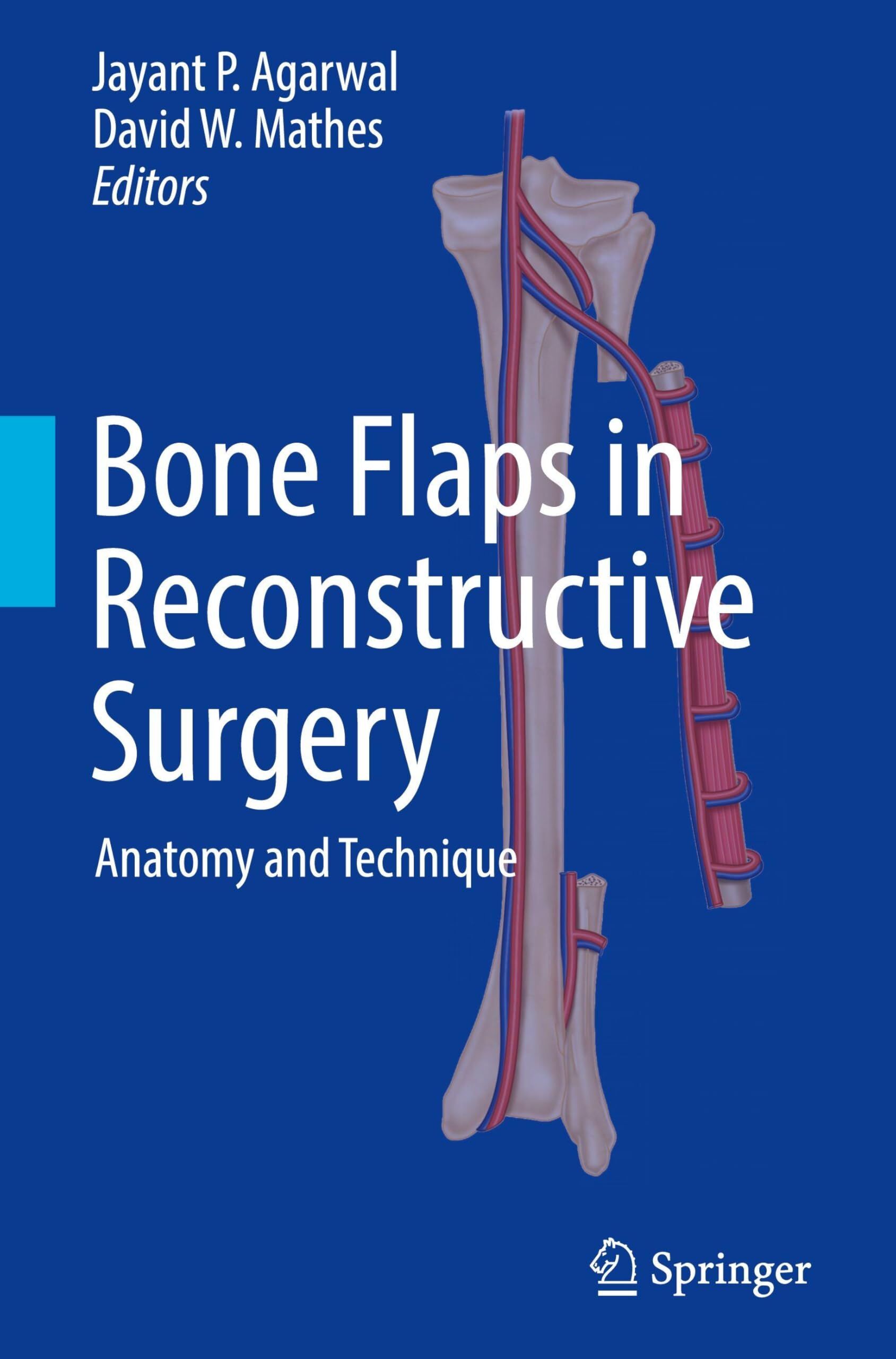 Bone Flaps in Reconstructive Surgery