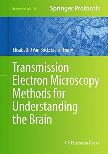 Transmission Electron Microscopy Methods for Understanding the Brain (Neuromethods)