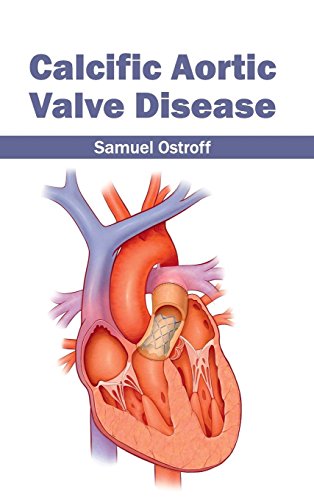 Calcific Aortic Valve Disease