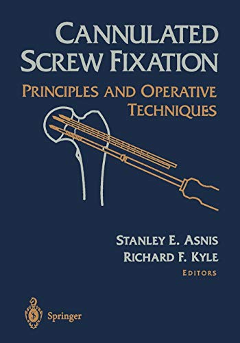 Cannulated Screw Fixation: Principles and Operative Techniques