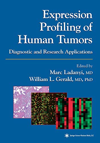 Expression Profiling of Human Tumors: Diagnostic And Research Applications