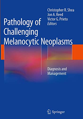 Pathology of Challenging Melanocytic Neoplasms: Diagnosis and Management