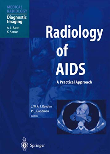 Radiology of AIDS (Medical Radiology / Diagnostic Imaging)