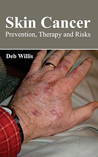 Skin Cancer: Prevention, Therapy and Risks